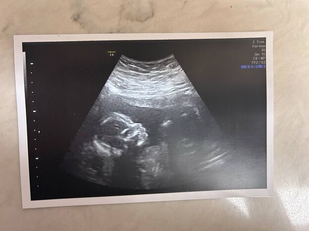 FBMI Missionary Dustin Schurg Prayer Letter Picture