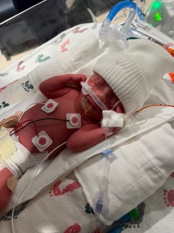 FBMI Missionaries Jared & Tiffany Stalnaker Prayer Letter Picture